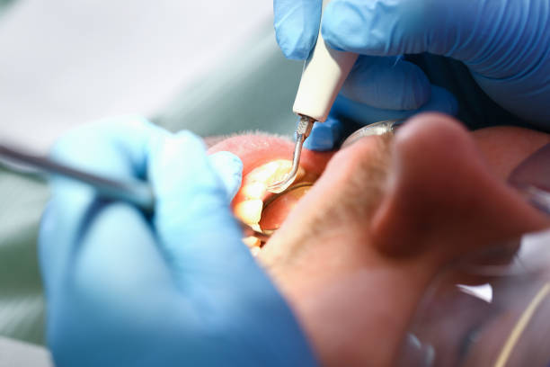 Best Emergency Dental Surgery in Pryor Creek, OK