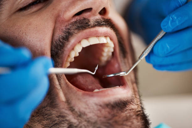 Best Same-Day Emergency Dentist in Pryor Creek, OK